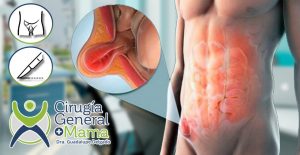 doctores, cirujano, cirujanos, doctoras, cirujano gastrointestinal, cirujano gastrointestinal y laparoscopia, cirujano general, laparoscopía, cirugia, hernias, hernias inguinales, vesícula, vesicula, hemorroides, fisuras anales, apendicectomía, apendicectomia, biopsias, cancer de mama, mastectomia, cáncer de mama, mastectomía, cirugía Conservadora de mama, cirugía Conservadora de mama, ganglio Centinela, seguimiento en cancer de mama, seguimiento en cáncer de mama, check up de la mujer, escleroterapia, úlceras, ulceras, heridas, apendicitis, piedras en vesicula, piedras en riñones, lipomas, doctores slp, cirujano slp, cirujanos slp, doctoras slp, cirujano gastrointestinal slp, cirujano gastrointestinal y laparoscopia slp, cirujano general slp, laparoscopía slp, cirugia slp, hernias slp, hernias inguinales slp, vesícula slp, vesicula slp, hemorroides slp, fisuras anales slp, apendicectomía slp, apendicectomia slp, biopsias slp, cancer de mama slp, mastectomia slp, cáncer de mama slp, mastectomía slp, cirugía Conservadora de mama slp, cirugía Conservadora de mama slp, ganglio Centinela slp, seguimiento en cancer de mama slp, seguimiento en cáncer de mama slp, check up de la mujer slp, escleroterapia slp, úlceras slp, ulceras slp, heridas slp, apendicitis slp, piedras en vesicula slp, piedras en riñones slp, lipomas slp, doctores san luis potosi, cirujano san luis potosi, cirujanos san luis potosi, doctoras san luis potosi, cirujano gastrointestinal san luis potosi, cirujano gastrointestinal y laparoscopia san luis potosi, cirujano general san luis potosi, laparoscopía san luis potosi, cirugia san luis potosi, hernias san luis potosi, hernias inguinales san luis potosi, vesícula san luis potosi, vesicula san luis potosi, hemorroides san luis potosi, fisuras anales san luis potosi, apendicectomía san luis potosi, apendicectomia san luis potosi, biopsias san luis potosi, cancer de mama san luis potosi, mastectomia san luis potosi, cáncer de mama san luis potosi, mastectomía san luis potosi, cirugía Conservadora de mama san luis potosi, cirugía Conservadora de mama san luis potosi, ganglio Centinela san luis potosi, seguimiento en cancer de mama san luis potosi, seguimiento en cáncer de mama san luis potosi, check up de la mujer san luis potosi, escleroterapia san luis potosi, úlceras san luis potosi, ulceras san luis potosi, heridas san luis potosi, apendicitis san luis potosi, piedras en vesicula san luis potosi, piedras en riñones san luis potosi, lipomas san luis potosi, doctores san luis potosí, cirujano san luis potosí, cirujanos san luis potosí, doctoras san luis potosí, cirujano gastrointestinal san luis potosí, cirujano gastrointestinal y laparoscopia san luis potosí, cirujano general san luis potosí, laparoscopía san luis potosí, cirugia, hernias san luis potosí, hernias inguinales san luis potosí, vesícula san luis potosí, vesicula san luis potosí, hemorroides san luis potosí, fisuras anales san luis potosí, apendicectomía san luis potosí, apendicectomia san luis potosí, biopsias san luis potosí, cancer de mama san luis potosí, mastectomia san luis potosí, cáncer de mama san luis potosí, mastectomía san luis potosí, cirugía Conservadora de mama san luis potosí, cirugía Conservadora de mama san luis potosí, ganglio Centinela san luis potosí, seguimiento en cancer de mama san luis potosí, seguimiento en cáncer de mama san luis potosí, check up de la mujer san luis potosí, escleroterapia san luis potosí, úlceras, ulceras san luis potosí, heridas san luis potosí, apendicitis san luis potosí, piedras en vesicula san luis potosí, piedras en riñones san luis potosí, lipomas san luis potosí, Dra. Guadalupe Delgado Cirujano Gastrointestinal en San Luis Potosí, especialista hernias en San Luis Potosi, Especialista piedras en la vesícula en San Luis Potosi, Especialista apendicitis en San Luis Potosi, Especialista hemorroides en San Luis Potosi, Especialista lipomas en San Luis Potosi, Especialista reflujo gastroesofágico en San Luis Potosi, Especialista cáncer de mama en San Luis Potosi, Especialista piedras en la vesicula en San Luis Potosi, Especialista reflujo gastroesofagico en San Luis Potosi, Especialista cancer de mama en San Luis Potosi, especialista hernias en slp, Especialista piedras en la vesícula en slp, Especialista apendicitis en slp, Especialista hemorroides en slp, Especialista lipomas en slp, Especialista reflujo gastroesofágico en slp, Especialista cáncer de mama en slp, Especialista piedras en la vesicula en slp, Especialista reflujo gastroesofagico en slp, Especialista cancer de mama en slp
