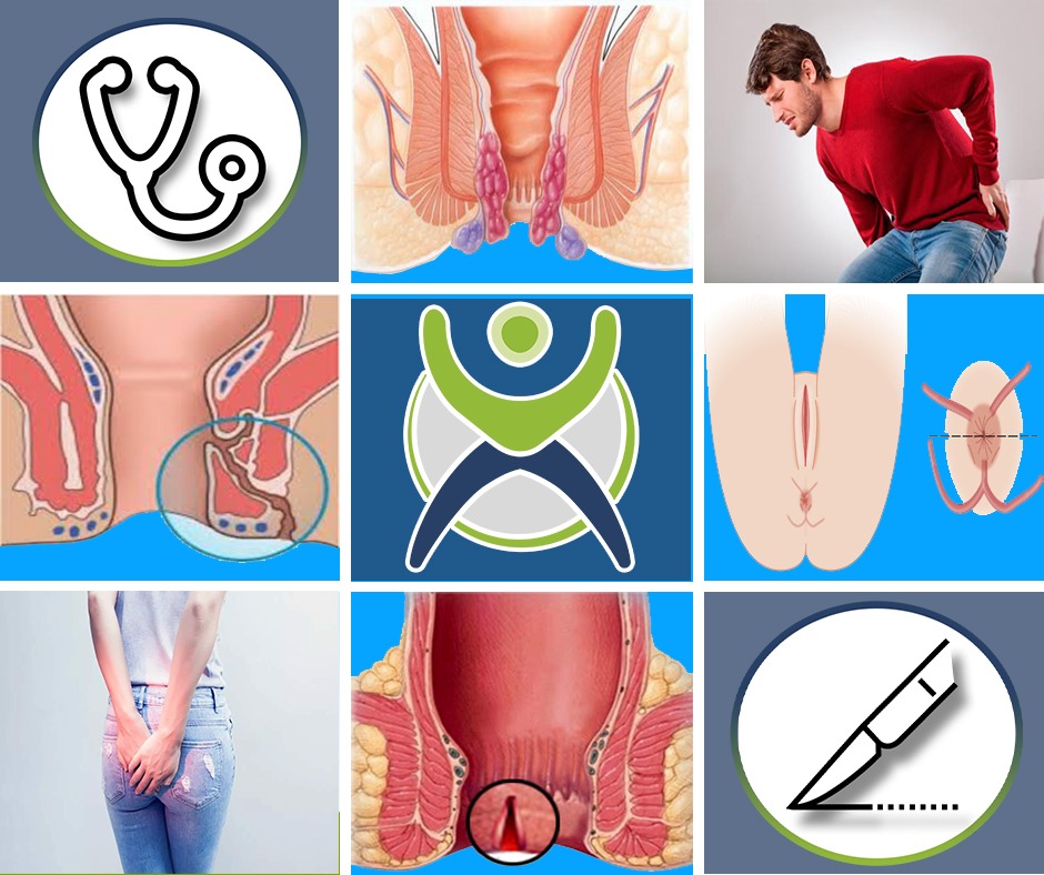 doctores, cirujano, cirujanos, doctoras, cirujano gastrointestinal, cirujano gastrointestinal y laparoscopia, cirujano general, laparoscopía, cirugia, hernias, hernias inguinales, vesícula, vesicula, hemorroides, fisuras anales, apendicectomía, apendicectomia, biopsias, cancer de mama, mastectomia, cáncer de mama, mastectomía, cirugía Conservadora de mama, cirugía Conservadora de mama, ganglio Centinela, seguimiento en cancer de mama, seguimiento en cáncer de mama, check up de la mujer, escleroterapia, úlceras, ulceras, heridas, apendicitis, piedras en vesicula, piedras en riñones, lipomas, doctores slp, cirujano slp, cirujanos slp, doctoras slp, cirujano gastrointestinal slp, cirujano gastrointestinal y laparoscopia slp, cirujano general slp, laparoscopía slp, cirugia slp, hernias slp, hernias inguinales slp, vesícula slp, vesicula slp, hemorroides slp, fisuras anales slp, apendicectomía slp, apendicectomia slp, biopsias slp, cancer de mama slp, mastectomia slp, cáncer de mama slp, mastectomía slp, cirugía Conservadora de mama slp, cirugía Conservadora de mama slp, ganglio Centinela slp, seguimiento en cancer de mama slp, seguimiento en cáncer de mama slp, check up de la mujer slp, escleroterapia slp, úlceras slp, ulceras slp, heridas slp, apendicitis slp, piedras en vesicula slp, piedras en riñones slp, lipomas slp, doctores san luis potosi, cirujano san luis potosi, cirujanos san luis potosi, doctoras san luis potosi, cirujano gastrointestinal san luis potosi, cirujano gastrointestinal y laparoscopia san luis potosi, cirujano general san luis potosi, laparoscopía san luis potosi, cirugia san luis potosi, hernias san luis potosi, hernias inguinales san luis potosi, vesícula san luis potosi, vesicula san luis potosi, hemorroides san luis potosi, fisuras anales san luis potosi, apendicectomía san luis potosi, apendicectomia san luis potosi, biopsias san luis potosi, cancer de mama san luis potosi, mastectomia san luis potosi, cáncer de mama san luis potosi, mastectomía san luis potosi, cirugía Conservadora de mama san luis potosi, cirugía Conservadora de mama san luis potosi, ganglio Centinela san luis potosi, seguimiento en cancer de mama san luis potosi, seguimiento en cáncer de mama san luis potosi, check up de la mujer san luis potosi, escleroterapia san luis potosi, úlceras san luis potosi, ulceras san luis potosi, heridas san luis potosi, apendicitis san luis potosi, piedras en vesicula san luis potosi, piedras en riñones san luis potosi, lipomas san luis potosi, doctores san luis potosí, cirujano san luis potosí, cirujanos san luis potosí, doctoras san luis potosí, cirujano gastrointestinal san luis potosí, cirujano gastrointestinal y laparoscopia san luis potosí, cirujano general san luis potosí, laparoscopía san luis potosí, cirugia, hernias san luis potosí, hernias inguinales san luis potosí, vesícula san luis potosí, vesicula san luis potosí, hemorroides san luis potosí, fisuras anales san luis potosí, apendicectomía san luis potosí, apendicectomia san luis potosí, biopsias san luis potosí, cancer de mama san luis potosí, mastectomia san luis potosí, cáncer de mama san luis potosí, mastectomía san luis potosí, cirugía Conservadora de mama san luis potosí, cirugía Conservadora de mama san luis potosí, ganglio Centinela san luis potosí, seguimiento en cancer de mama san luis potosí, seguimiento en cáncer de mama san luis potosí, check up de la mujer san luis potosí, escleroterapia san luis potosí, úlceras, ulceras san luis potosí, heridas san luis potosí, apendicitis san luis potosí, piedras en vesicula san luis potosí, piedras en riñones san luis potosí, lipomas san luis potosí, Dra. Guadalupe Delgado Cirujano Gastrointestinal en San Luis Potosí, especialista hernias en San Luis Potosi, Especialista piedras en la vesícula en San Luis Potosi, Especialista apendicitis en San Luis Potosi, Especialista hemorroides en San Luis Potosi, Especialista lipomas en San Luis Potosi, Especialista reflujo gastroesofágico en San Luis Potosi, Especialista cáncer de mama en San Luis Potosi, Especialista piedras en la vesicula en San Luis Potosi, Especialista reflujo gastroesofagico en San Luis Potosi, Especialista cancer de mama en San Luis Potosi, especialista hernias en slp, Especialista piedras en la vesícula en slp, Especialista apendicitis en slp, Especialista hemorroides en slp, Especialista lipomas en slp, Especialista reflujo gastroesofágico en slp, Especialista cáncer de mama en slp, Especialista piedras en la vesicula en slp, Especialista reflujo gastroesofagico en slp, Especialista cancer de mama en slp