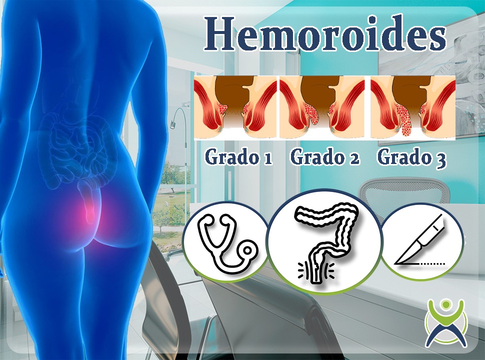 doctores, cirujano, cirujanos, doctoras, cirujano gastrointestinal, cirujano gastrointestinal y laparoscopia, cirujano general, laparoscopía, cirugia, hernias, hernias inguinales, vesícula, vesicula, hemorroides, fisuras anales, apendicectomía, apendicectomia, biopsias, cancer de mama, mastectomia, cáncer de mama, mastectomía, cirugía Conservadora de mama, cirugía Conservadora de mama, ganglio Centinela, seguimiento en cancer de mama, seguimiento en cáncer de mama, check up de la mujer, escleroterapia, úlceras, ulceras, heridas, apendicitis, piedras en vesicula, piedras en riñones, lipomas, doctores slp, cirujano slp, cirujanos slp, doctoras slp, cirujano gastrointestinal slp, cirujano gastrointestinal y laparoscopia slp, cirujano general slp, laparoscopía slp, cirugia slp, hernias slp, hernias inguinales slp, vesícula slp, vesicula slp, hemorroides slp, fisuras anales slp, apendicectomía slp, apendicectomia slp, biopsias slp, cancer de mama slp, mastectomia slp, cáncer de mama slp, mastectomía slp, cirugía Conservadora de mama slp, cirugía Conservadora de mama slp, ganglio Centinela slp, seguimiento en cancer de mama slp, seguimiento en cáncer de mama slp, check up de la mujer slp, escleroterapia slp, úlceras slp, ulceras slp, heridas slp, apendicitis slp, piedras en vesicula slp, piedras en riñones slp, lipomas slp, doctores san luis potosi, cirujano san luis potosi, cirujanos san luis potosi, doctoras san luis potosi, cirujano gastrointestinal san luis potosi, cirujano gastrointestinal y laparoscopia san luis potosi, cirujano general san luis potosi, laparoscopía san luis potosi, cirugia san luis potosi, hernias san luis potosi, hernias inguinales san luis potosi, vesícula san luis potosi, vesicula san luis potosi, hemorroides san luis potosi, fisuras anales san luis potosi, apendicectomía san luis potosi, apendicectomia san luis potosi, biopsias san luis potosi, cancer de mama san luis potosi, mastectomia san luis potosi, cáncer de mama san luis potosi, mastectomía san luis potosi, cirugía Conservadora de mama san luis potosi, cirugía Conservadora de mama san luis potosi, ganglio Centinela san luis potosi, seguimiento en cancer de mama san luis potosi, seguimiento en cáncer de mama san luis potosi, check up de la mujer san luis potosi, escleroterapia san luis potosi, úlceras san luis potosi, ulceras san luis potosi, heridas san luis potosi, apendicitis san luis potosi, piedras en vesicula san luis potosi, piedras en riñones san luis potosi, lipomas san luis potosi, doctores san luis potosí, cirujano san luis potosí, cirujanos san luis potosí, doctoras san luis potosí, cirujano gastrointestinal san luis potosí, cirujano gastrointestinal y laparoscopia san luis potosí, cirujano general san luis potosí, laparoscopía san luis potosí, cirugia, hernias san luis potosí, hernias inguinales san luis potosí, vesícula san luis potosí, vesicula san luis potosí, hemorroides san luis potosí, fisuras anales san luis potosí, apendicectomía san luis potosí, apendicectomia san luis potosí, biopsias san luis potosí, cancer de mama san luis potosí, mastectomia san luis potosí, cáncer de mama san luis potosí, mastectomía san luis potosí, cirugía Conservadora de mama san luis potosí, cirugía Conservadora de mama san luis potosí, ganglio Centinela san luis potosí, seguimiento en cancer de mama san luis potosí, seguimiento en cáncer de mama san luis potosí, check up de la mujer san luis potosí, escleroterapia san luis potosí, úlceras, ulceras san luis potosí, heridas san luis potosí, apendicitis san luis potosí, piedras en vesicula san luis potosí, piedras en riñones san luis potosí, lipomas san luis potosí, Dra. Guadalupe Delgado Cirujano Gastrointestinal en San Luis Potosí, especialista hernias en San Luis Potosi, Especialista piedras en la vesícula en San Luis Potosi, Especialista apendicitis en San Luis Potosi, Especialista hemorroides en San Luis Potosi, Especialista lipomas en San Luis Potosi, Especialista reflujo gastroesofágico en San Luis Potosi, Especialista cáncer de mama en San Luis Potosi, Especialista piedras en la vesicula en San Luis Potosi, Especialista reflujo gastroesofagico en San Luis Potosi, Especialista cancer de mama en San Luis Potosi, especialista hernias en slp, Especialista piedras en la vesícula en slp, Especialista apendicitis en slp, Especialista hemorroides en slp, Especialista lipomas en slp, Especialista reflujo gastroesofágico en slp, Especialista cáncer de mama en slp, Especialista piedras en la vesicula en slp, Especialista reflujo gastroesofagico en slp, Especialista cancer de mama en slp